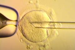 Mitochondria Dna Technique Embryo Babies Children