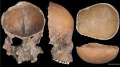 Bones Study People Stone Age Skull Researchers