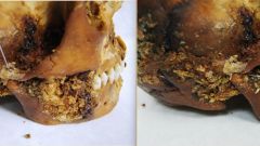 Researchers Pazyryk Jaw Woman's Injury Skull