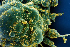Breakthrough Cells T Cov Sars Cov Infections