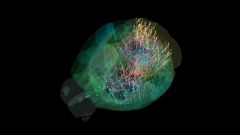 Brain Mice Activity Carandini Labs Findings