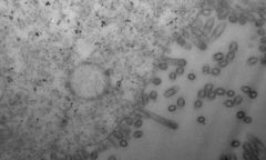 H9n2 Health Ministry Italy Reports Europe's Ecdc Health Ministry National Laboratory European Union